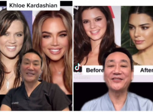 Najpoznatiji holivudski HIRURG otkrio kako su ZVEZDE izgledale PRE operacija: Jedna je ZAVISNA od botoksa, dok druga izgleda SAVRŠENO uz minimalne korekcije