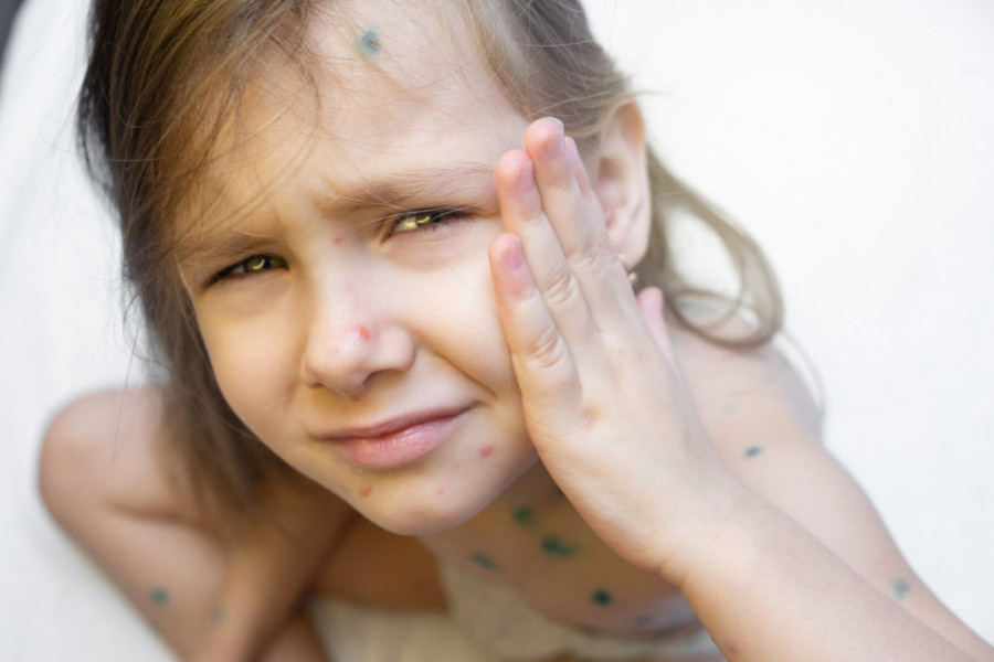 Njena ćerka (6) ima neobičnu ALERGIJU i može da umre u svakom trenutku: Hrabra majka sada razmišlja da napusti zemlju, jer devojčica reaguje na nešto na šta smo svi navikli