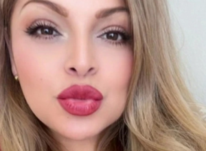 Koru od ovog voća koristi da ukloni bore: "Znam da je odvratno, ali je jeftinije od botoksa i zaista deluje"