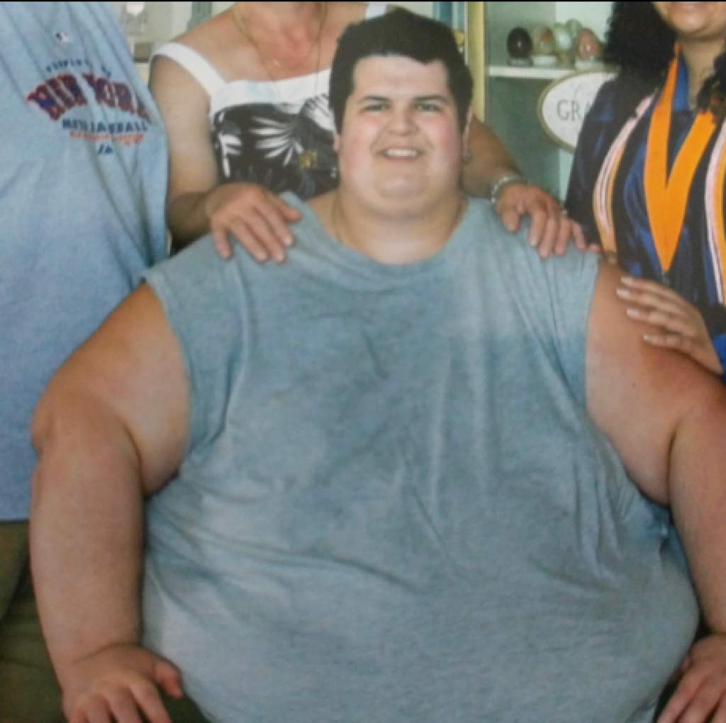 Imao je 317 kilograma: Lekari su mu rekli da će umreti pre 40. godine, a onda je promenio život iz korena