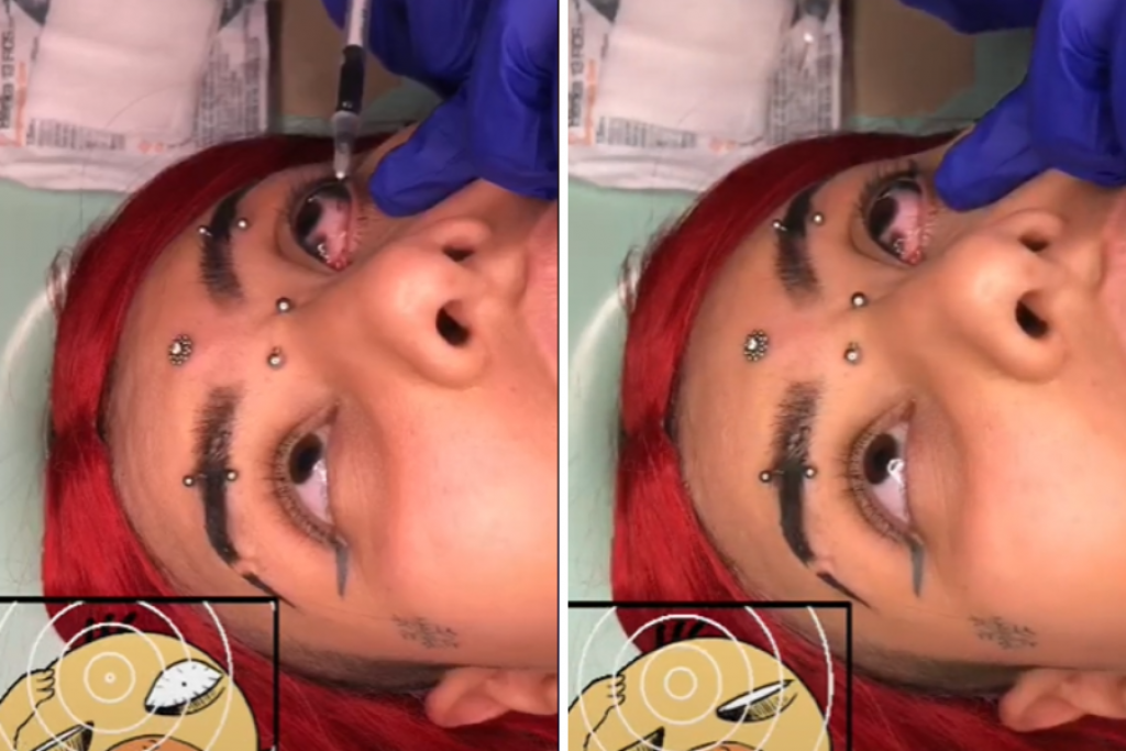UZNEMIRUJUĆI VIDEO Odlučila je da doda još jednu TETOVAŽU pa istetovirala BEONJAČE