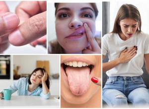 U ustima i na NOKTIMA se može videti nedostatak MINERALA: Ovo su samo NEKI simptomi da je vaše zdravlje OZBILJNO narušeno