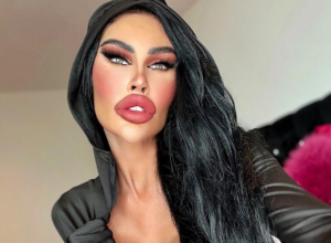 Ni majka rođena je ne prepoznaje: Tara je potrošila preko SEDAM miliona dinara na estetske operacije, samo je grudi uvećavala PET puta