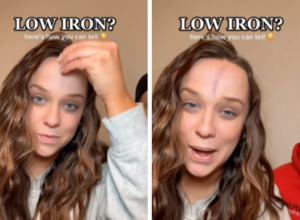 Uradite KUĆNI TEST i proverite da li vam fali gvožđa: Potrebno je samo da protrljate ČELO sa ovim predmetom