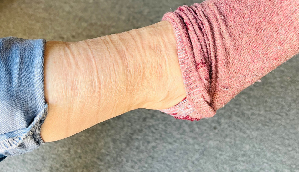 Leti se voda gomila u nogama i stomaku: Uz pomoć ovog minerala izduvaćete se kao balon