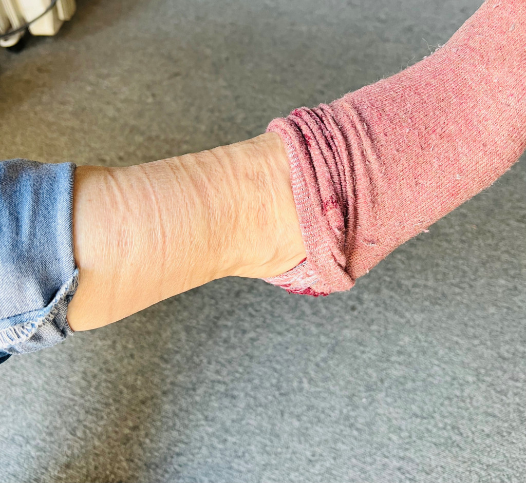 Leti se voda gomila u nogama i stomaku: Uz pomoć ovog minerala izduvaćete se kao balon