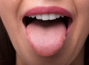 Znak na jeziku može da bude signal opake bolesti: Ako osetite i ove simptome, obavezno se javite lekaru