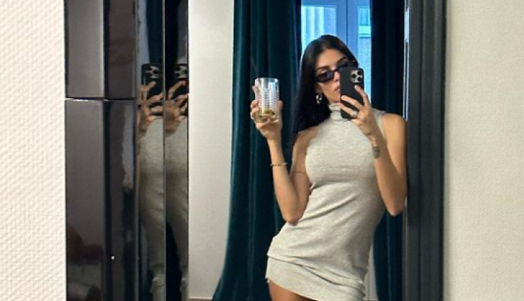 Pre modelinga, Jovana je radila na pumpi: U nesreći je spržila pola tela, a danas je žena fudbalera i uživa u luksuzu