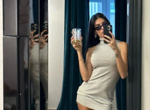 Pre modelinga, Jovana je radila na pumpi: U nesreći je spržila pola tela, a danas je žena fudbalera i uživa u luksuzu