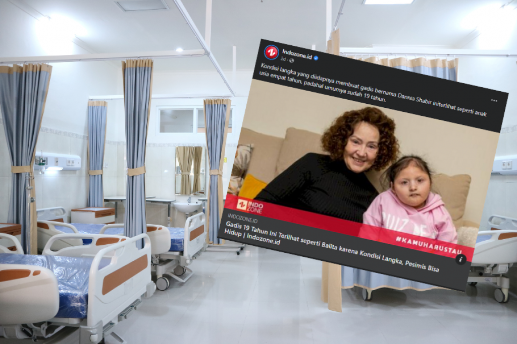 Zbog veoma RETKE bolesti ona izgleda kao dete: Ima manje od 20 kilograma, a kreće se samo pomoću KOLICA