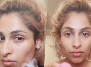 Način na koji dišete može da vam DEFORMIŠE lice: Od ovog momenta ćete razmišljati o tome