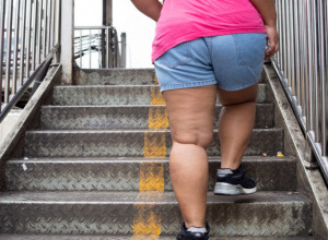 Gojaznost je opasnija po žene: Naučnici otkrili ogroman rizik koji nastaje zbog prekomerne kilaže, problem izazivaju ove navike