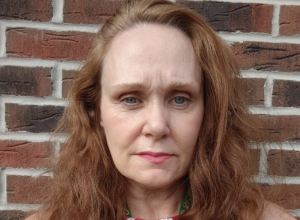 Preživela je moždani udar i dobila dijagnozu AFAZIJE: Danas ima 54 godine i radi kao MODEL