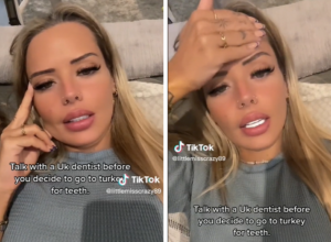 Holivudski osmeh iz TURSKE koštao ju je MNOGO: Sada ne može ni USTA da zatvori, a ovo se dešava kada progovori (VIDEO)