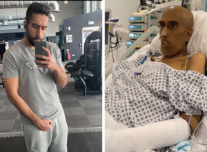 Život mu se za TREN OKA promenio: Otišao je u bolnicu sa blagom TEMPERATUROM, a posle mesec dana ostao bez RUKE i NOGE