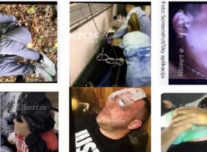 UMESTO MRVALJEVIĆA DOKTORU O POVREDAMA GOVORILI POLICAJCI: Oglasio se Ombudsman