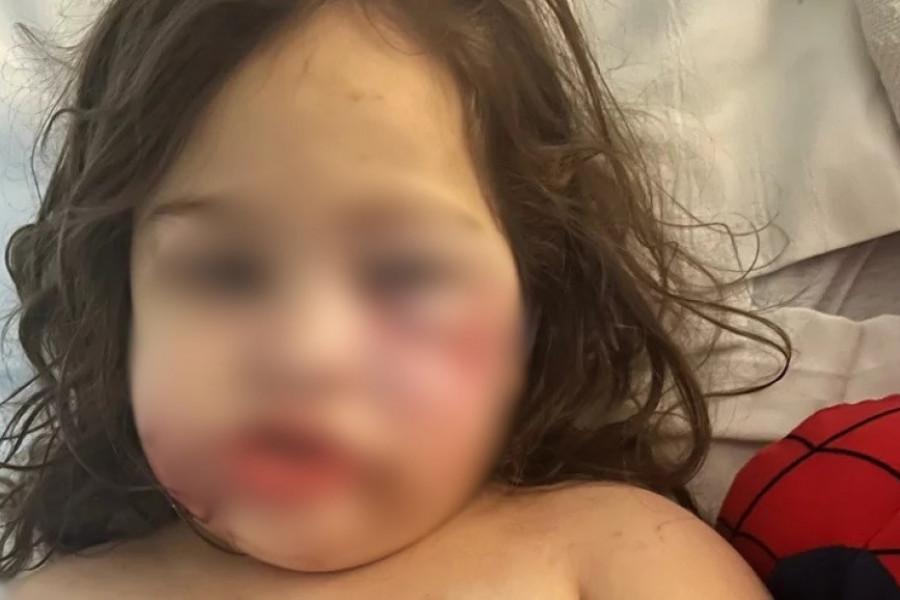 Devojčica (3) je samo želela psa: Roditelji su udomili PITBULA, a onda je usledila DRAMA - Dete više nikada neće moći da se NASMEJE