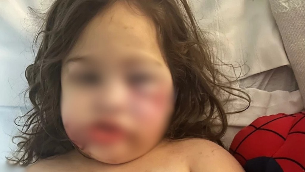 Devojčica (3) je samo želela psa: Roditelji su udomili PITBULA, a onda je usledila DRAMA - Dete više nikada neće moći da se NASMEJE