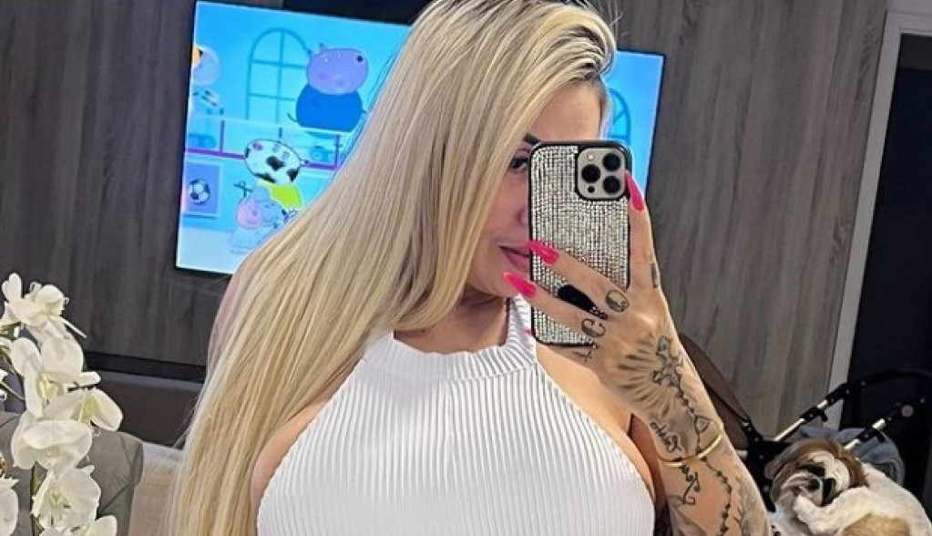 Litre filera i hijalurona je ubrizgala u svoju ZADNJICU: Htela je da postane REKORDERKA, a zgrozila se kad je videla šta je dobila