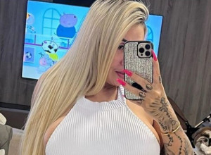 Litre filera i hijalurona je ubrizgala u svoju ZADNJICU: Htela je da postane REKORDERKA, a zgrozila se kad je videla šta je dobila