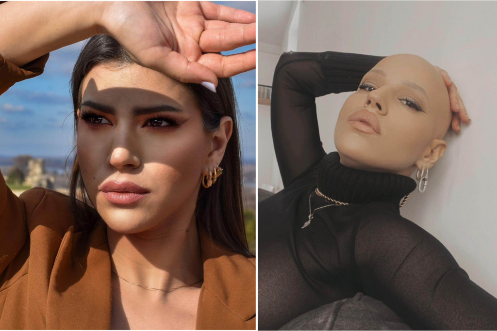 Vil Smit je ćelavost svoje žene branio ŠAMAROM: Sonju iz Beograda je ALOPECIJA naučila da kosa NIJE simbol ženstvenosti i lepote