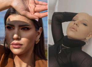 Vil Smit je ćelavost svoje žene branio ŠAMAROM: Sonju iz Beograda je ALOPECIJA naučila da kosa NIJE simbol ženstvenosti i lepote