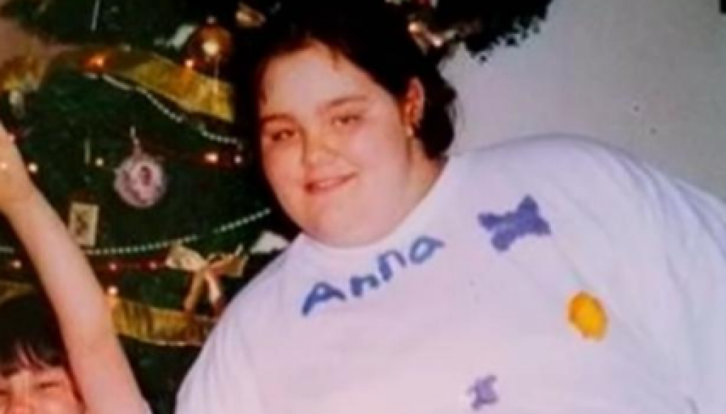 Ana je izgubila 152 kilograma: Htela je da deca budu ponosna na nju, a sada svoje telo mrzi još više