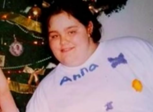 Ana je izgubila 152 kilograma: Htela je da deca budu ponosna na nju, a sada svoje telo mrzi još više