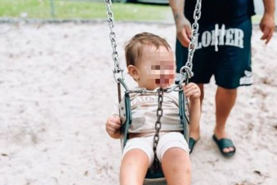 "Ti si čudovište": Na društvenim mrežama napali majku jer je bebi odstranila mladež