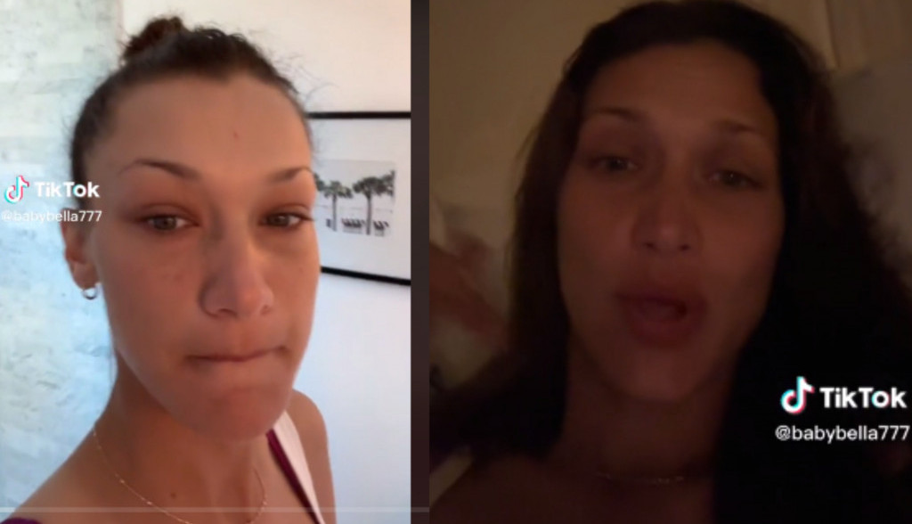 Bela Hadid se BORI sa infektivnom bolešću: Napada mozak, zube, nervni sistem, a dobija se ujedom KOMARCA