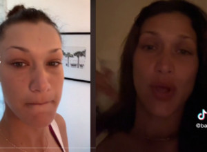 Bela Hadid se BORI sa infektivnom bolešću: Napada mozak, zube, nervni sistem, a dobija se ujedom KOMARCA