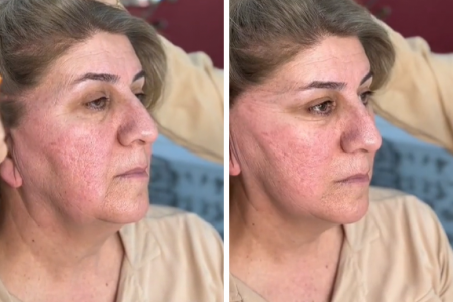 Vežite kosu na ovaj način i zategnite vaše LICE: Izgledaćete 10 godina mlađe