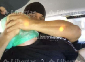 JEZIVO! NOVI DETALJI POLICIJSKE TORTURE: Spasao se tako što je progutao otvarač limenke i tako dospeo na operacioni sto