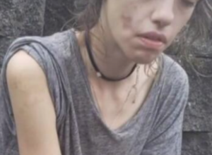 Bila je zavisnica i raspadala se od droge: A onda se desilo čudo, šokiraćete se kada vidite kako danas izgleda