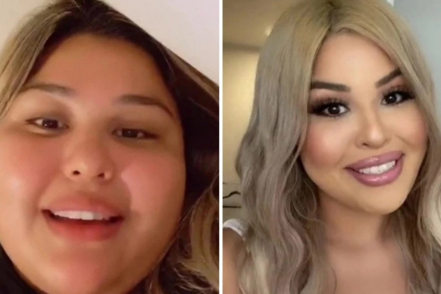 Ni jedna DIJETA joj nije pomogla da smrša: "Nakon 10 godina gojaznosti, lekari su izvadili nešto što me je uništavalo"