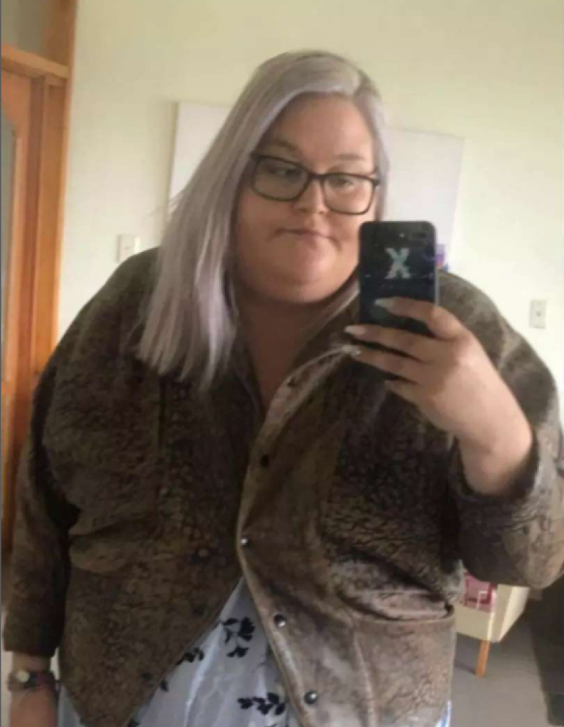 Imala je 170 kilograma i JEDVA JE HODALA: Ovo je transformacija od koje smo svi ZANEMELI!