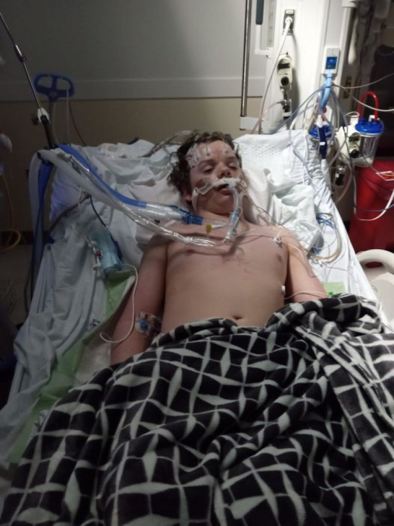 Nije mu bilo SPASA: Zbog TikTok izazova završio je na RESPIRATORU, a onda su roditelji dečaka (13) dobili NAJGORE vesti