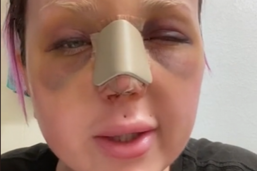 Želela je samo da bude LEPA, a sada prolazi kroz PAKAO: "Ovo je neizdrživo, zašto me niko nije upozorio"