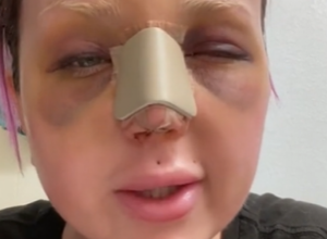 Želela je samo da bude LEPA, a sada prolazi kroz PAKAO: "Ovo je neizdrživo, zašto me niko nije upozorio"