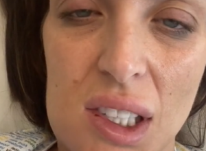 Jedva je izvukla živu glavu zbog greške ZUBARA: Želela je samo Holivudski osmeh, a završila sa ozbiljnom infekcijom (FOTO)