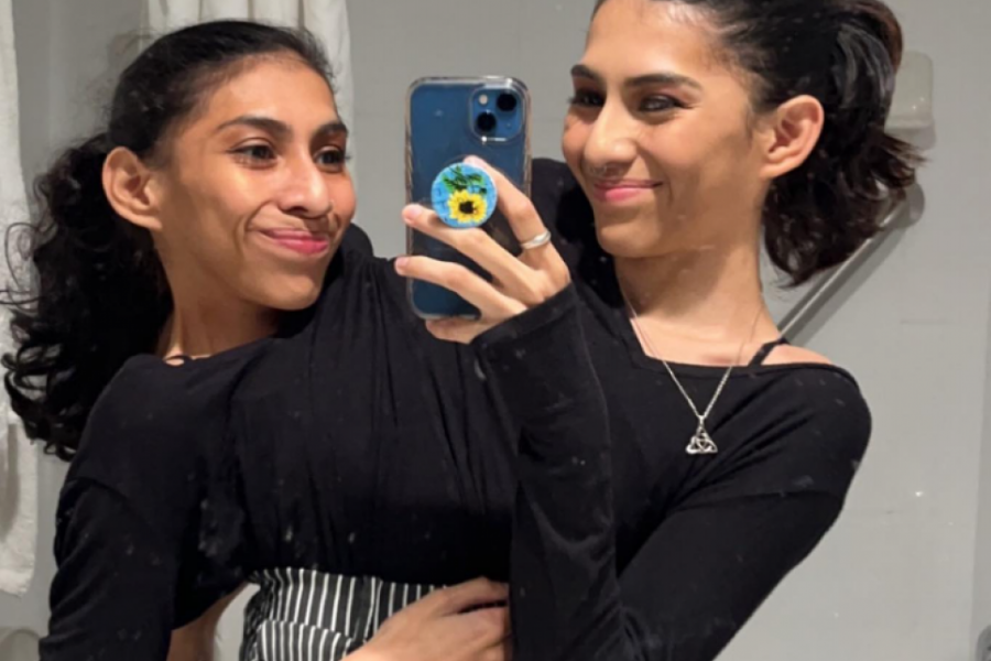 Imaju 22 godine i jedno telo: Sada je jedna BLIZNAKINJA pronašla dečka, a evo kako funkcioniše to