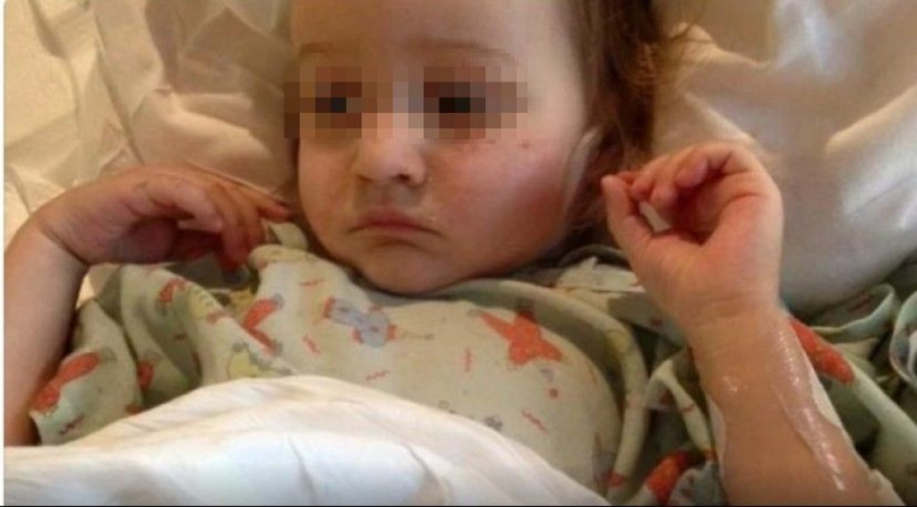 Devojčica (2) skoro umrla jer je PROGUTALA ovaj PREDMET: Svi mi ih prikupljamo i imamo u KUHINJI,  a ne slutimo koliko su opasni