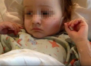 Devojčica (2) skoro umrla jer je PROGUTALA ovaj PREDMET: Svi mi ih prikupljamo i imamo u KUHINJI,  a ne slutimo koliko su opasni