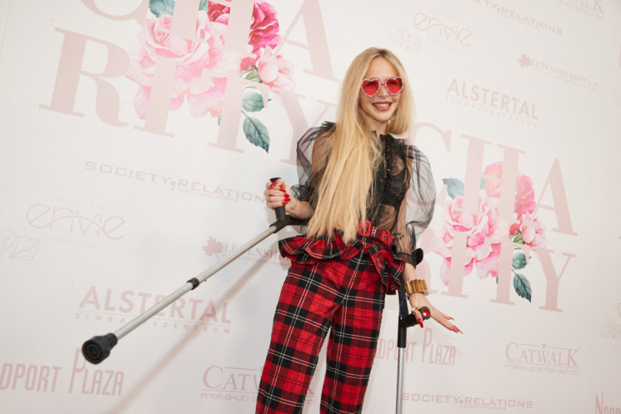 Potrošila je BOGATSTVO na operacije kako bi porasla par centimetara: Bila je visoka, a zbog KOMPLEKSA je otišla pod nož