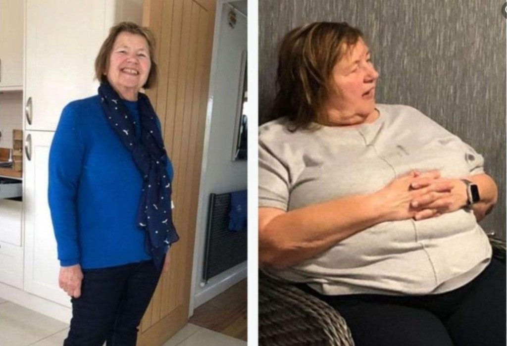 Anđa (74) je DOKAZ da se u životu sve može uz jaku volju: Smršala je 40 kilograma, a nije gladovala