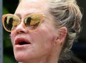 Po licu RANE, po rukama čudne kraste: Svi se pitaju šta se dešava s nekadašnjom vanserijskom lepoticom