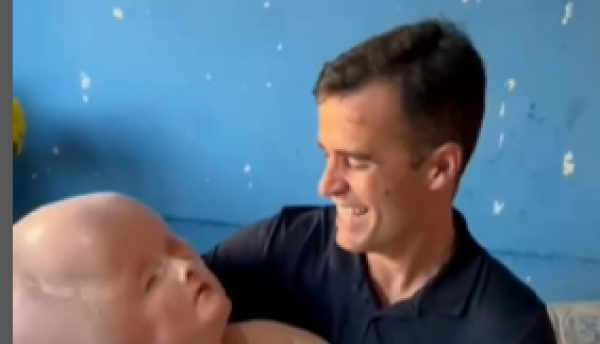 U trudnoći je bolovala od RUBEOLE, a kada se porodila, lekari su bebi dali samo tri meseca života (UZNEMIRUJUĆI VIDEO)