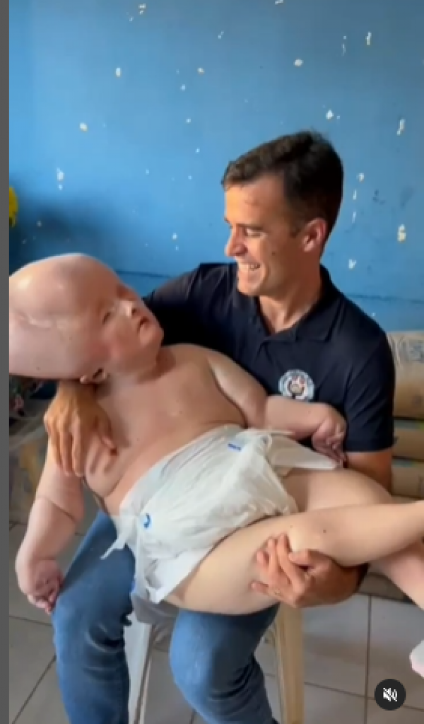 U trudnoći je bolovala od RUBEOLE, a kada se porodila, lekari su bebi dali samo tri meseca života (UZNEMIRUJUĆI VIDEO)