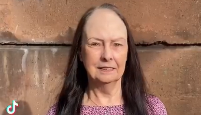 Nije mogla da se pogleda u ogledalo 20 godina: Jedna stvar je bila dovoljna da ponovo zavoli svoj odraz