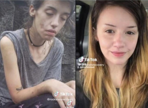 Reč je o istoj osobi, a niko ne može da poveruje: Teška zavisnica droge sada doživela je preporod